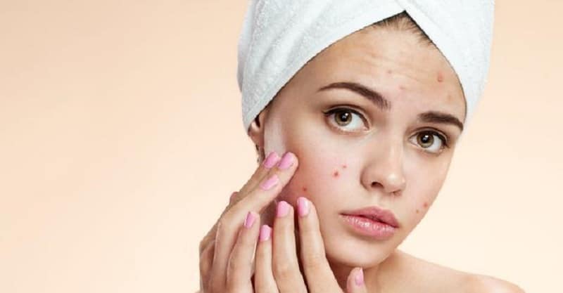 comment enlever les boutons sur le visage