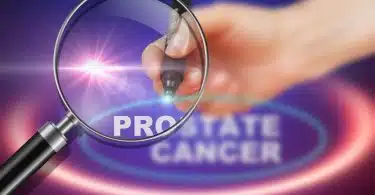 Les différents tests de diagnostic du cancer de la prostate