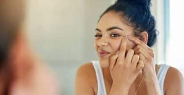 vitamine pour l'acné